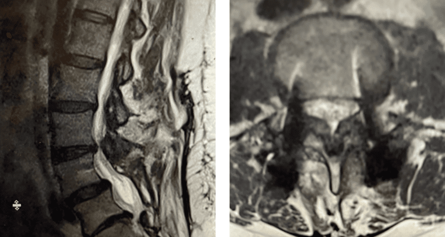 Figure 4 5 4